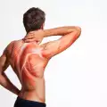 Упражнения за мускулите на гръбначния стълб облекчават болките в кръста