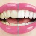 Билкова паста за бели зъби