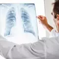 Причини за рак на белия дроб при непушачи