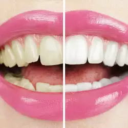 Билкова паста за бели зъби