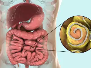 Как да се предпазим от вътрешни паразити