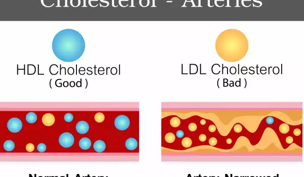 видове холестерол
