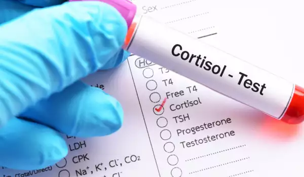 Високи нива на кортизол: симптоми и значение