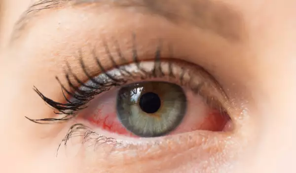 очни алергии