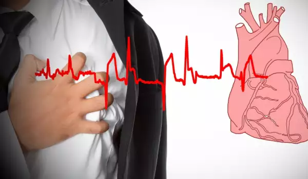 Как да разпознаем симптомите при инфаркт?