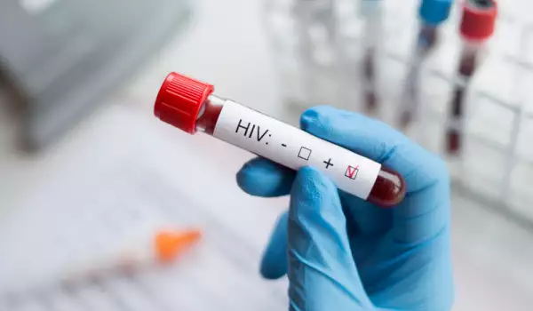 Пробив: Откриха начин за унищожаване на ХИВ вируса