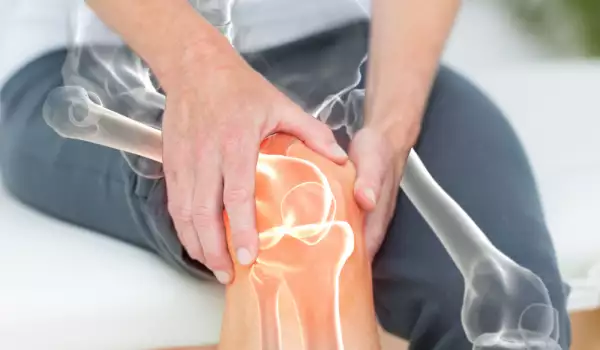 артрит в коляното