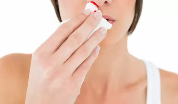 кървенето от носа е част от хеморагичните симптоми