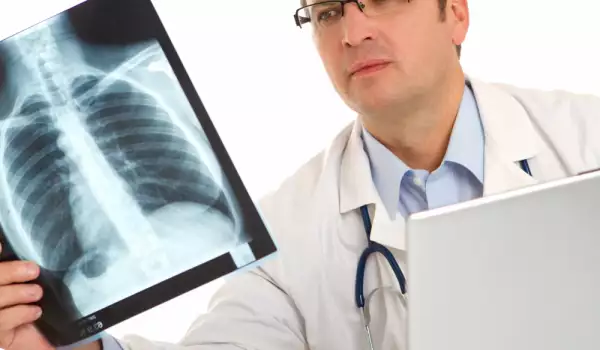 рентгенографията е метод на образната диагностика