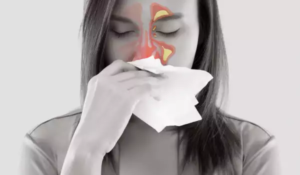 Как да спрем течащия нос
