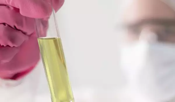 Опасен ли е белтъкът в урината?
