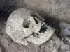 Пломби на 13 хиляди години изскочиха от устата на скелет в Италия
